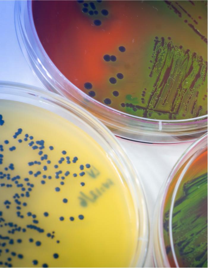 Análisis microbiológicos